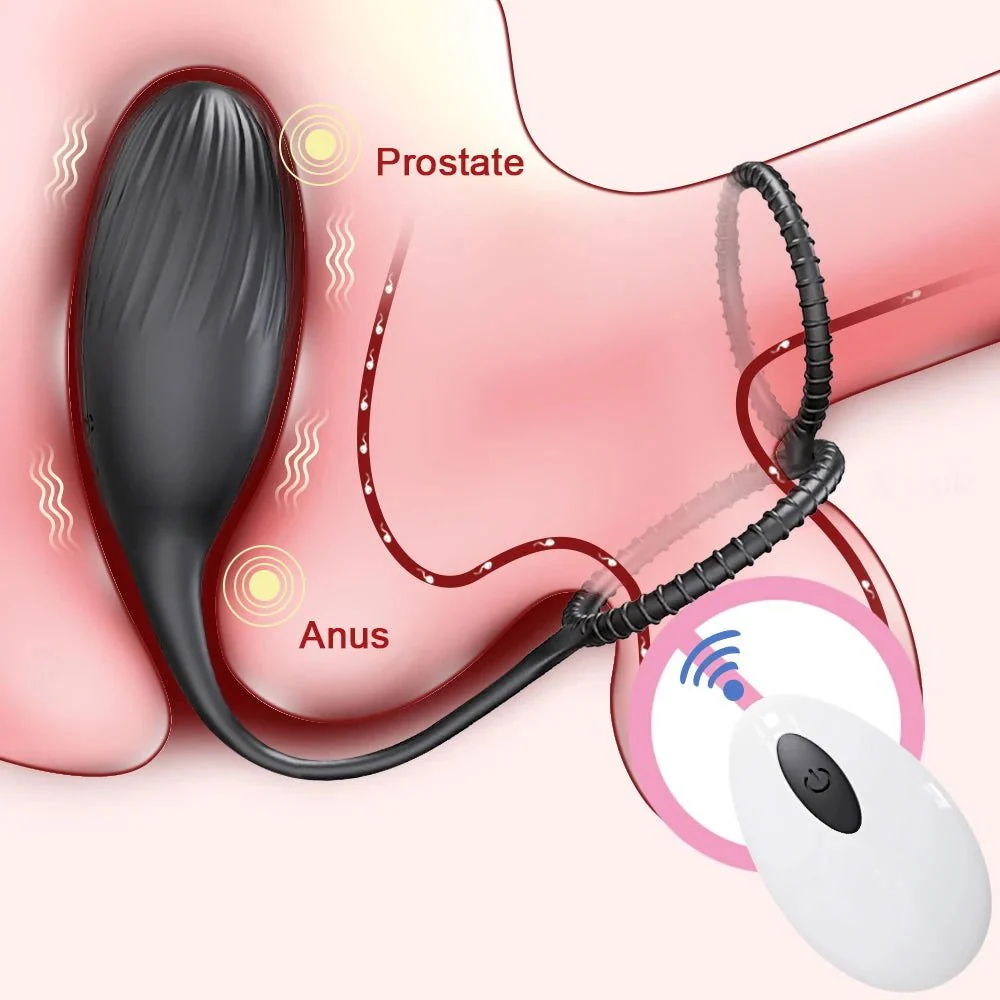 Wireless Control Prostate Massager Cock Ring - Image 2